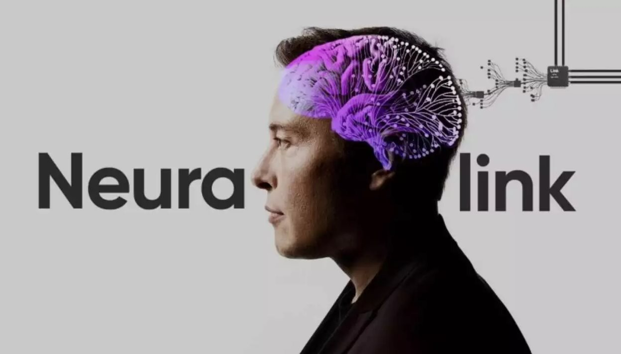 Tham vọng cấy chip vào não người của Elon Musk gặp trở ngại