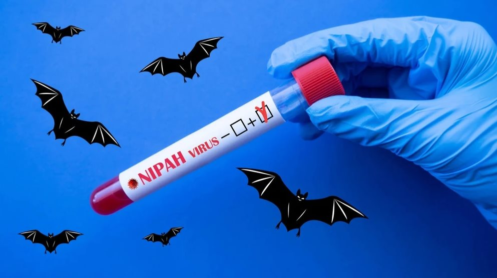 Dịch Nipah: 5 khuyến cáo từ Bộ Y tế mà mọi người cần biết