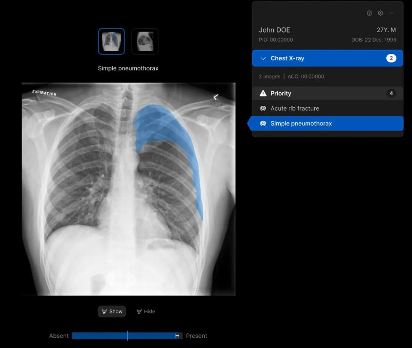 xray.png