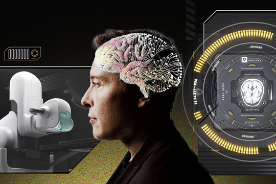 Giấc mơ cấy chip vào não người điên rồ của Elon Musk: Tự chế tạo robot phẫu thuật, sẽ thực hiện hơn 22.000 cuộc giải phẫu vào năm 2030, chi phí mỗi ca 10.000 USD