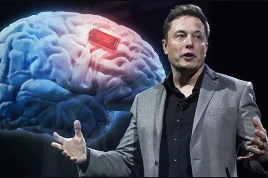 Gã ngông cuồng Elon Musk vừa làm được điều điên rồ: Lần đầu tiên cấy ghép thành công chip vào não người