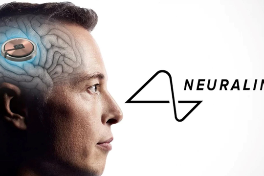 Công ty của Elon Musk cấy chip vào não người chỉ trong 1,5 giây, độ chính xác cực cao giúp tránh các mạch máu nhỏ
