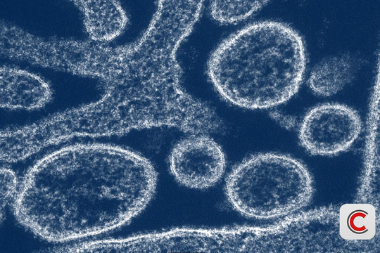 Nipah 2026: "Sát thủ" có tỷ lệ tử vong 40-75%, chưa có vaccine đặc hiệu