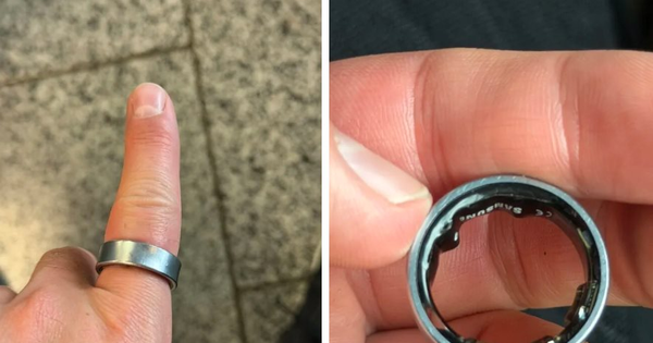 Người dùng hốt hoảng khi nhẫn thông minh Samsung phồng pin, kẹt luôn trên ngón tay: "Vừa đau vừa sợ nổ"