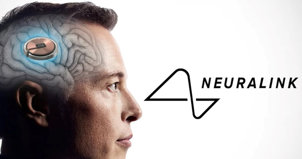 Công ty của Elon Musk cấy chip vào não người chỉ trong 1,5 giây, độ chính xác cực cao giúp tránh các mạch máu nhỏ